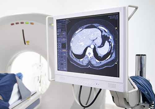 為什么IPS顯示技術(shù)應(yīng)用于診斷顯示器？